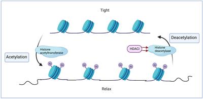 Current treatment strategies targeting histone deacetylase inhibitors in acute lymphocytic leukemia: a systematic review